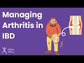 Managing Arthritis in IBD