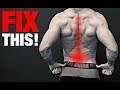 How To Fix A Bulging Disc NO SURGERY