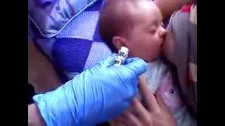 Poner pendientes bebé (1)