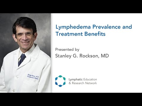 Lymphedema Prevalence and Treatment Benefits - Dr. Stanley Rockson