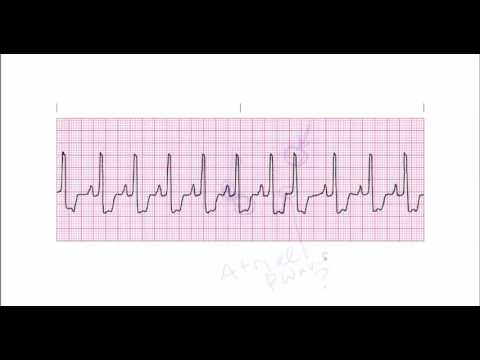 download lagu mp3 mp4 Pjc, download lagu Pjc gratis, unduh video klip Pjc