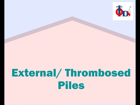 External/ Thrombosed Hemorrhoid  | Dr. Tulip JP Nagar