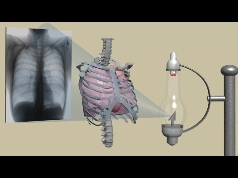 Chiropraktiker in Osteochondrose Schmerzen im Rücken der rechten Seite der Klinge