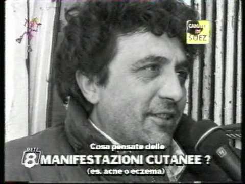 Trementina rozza per cura di eczema Risposte di perossido di idrogeno di psoriasi
