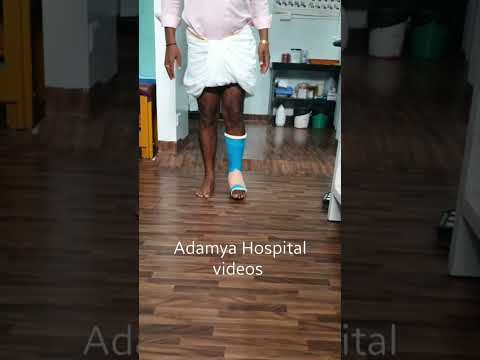 Jone's avulsion fracture | 5th Metatarsal base fracture | Conservative Fiberglass Plstr | Adamya H V