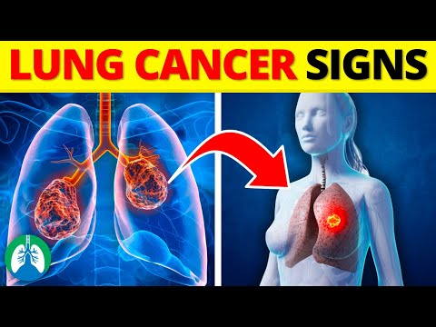 Early Warning Signs of Lung Cancer | Never Ignore These Symptoms
