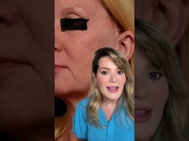 Quando o Facelifting é a melhor escolha?