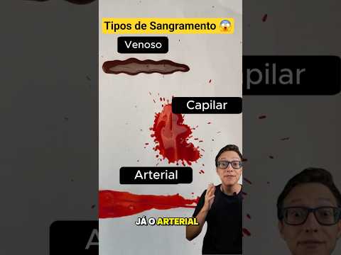 Tipos de Sangramento 😱#medicina #medico #enfermagem #enfermeiro #enfermeira arterial venoso capilar