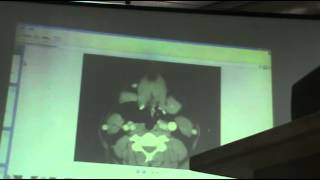 ENT - Dr.Nassem Talaat- Larynx (1) - Part 2
