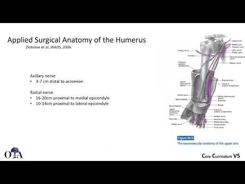 Humeral shaft fractures - 1 of 4