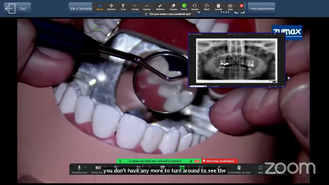 Dr Farnararo live @IDS 2023