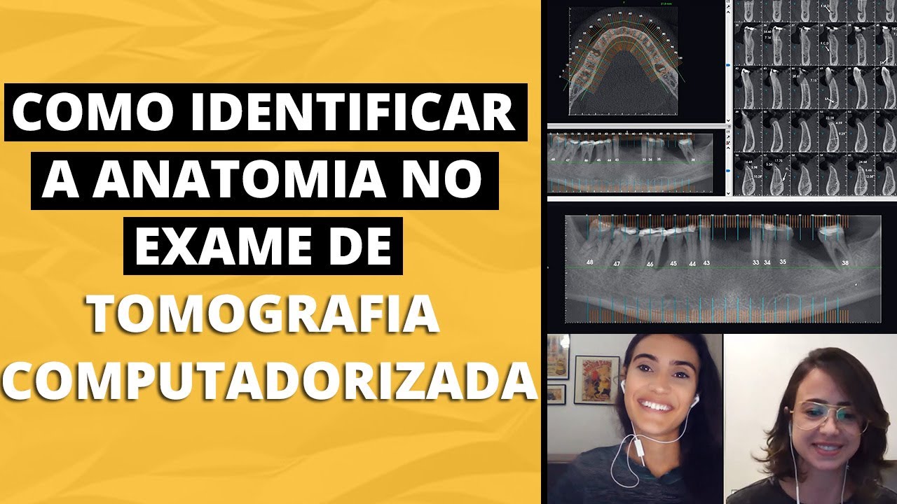 COMO IDENTIFICAR A ANATOMIA NO EXAME DE TOMOGRAFIA COMPUTADORIZADA