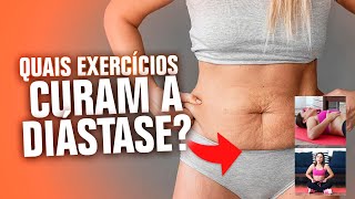 Quais Exercícios que curam a diástase sem cirurgia