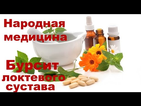 Лечение бурсита народными средствами