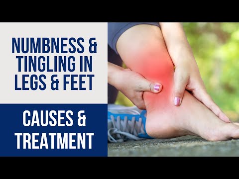 Leg & Foot Numbness & Tingling: Diagnosis & Treatment