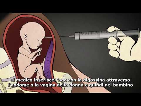 Cervicale osteocondrosi Trattamento di prodotti delle api Apparecchi per il trattamento magnetico delle articolazioni