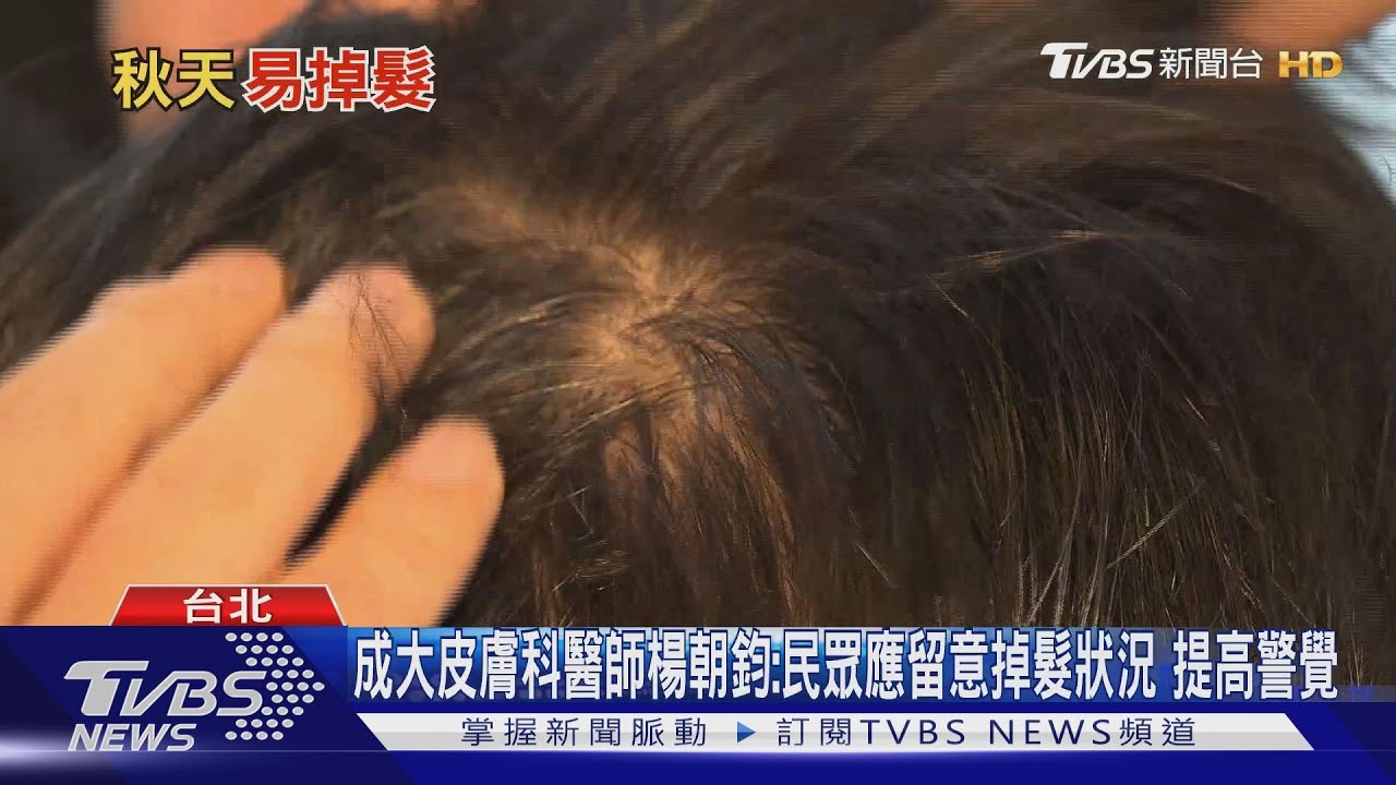 長期掉髮、秋天掉髮量增多 醫師:小心這因素引起