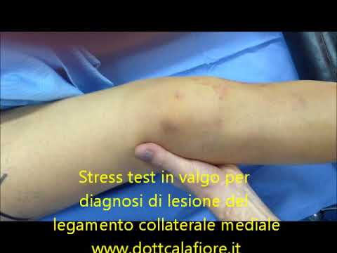 Si può morire di malattia degenerativa del disco Di osteocondrosi ginnastica terapeutica