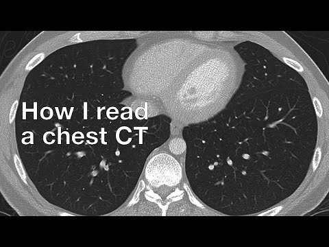 How I Read a Chest CT