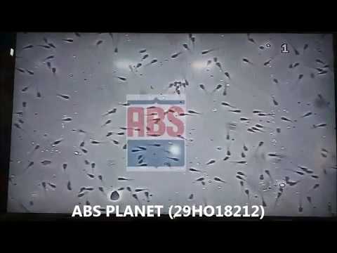 ABS Planet : Semen Motility