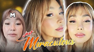 This is MIRACLE...!😍😍😍 | M's plastic surgery journey at Braun! (Part 2)