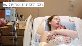 My Traumatic After Birth Story | Retained Placenta