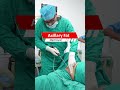 Axillary Fat Removal #short #shorts #Shortvideo #AxillaryFatRemoval #AxillaryFat #Axillary #Fat