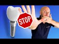(Don't) Get Dental Implants WITHOUT Knowing These 5 Things!
