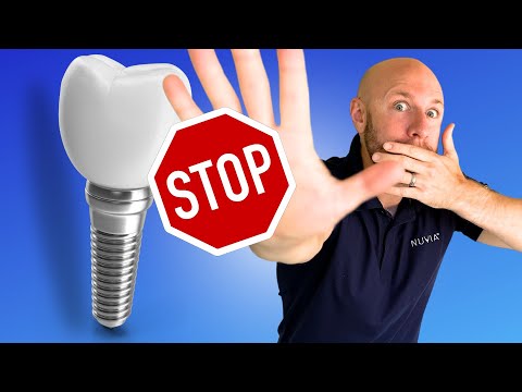 3rd YouTube video about are you put to sleep for teeth implants