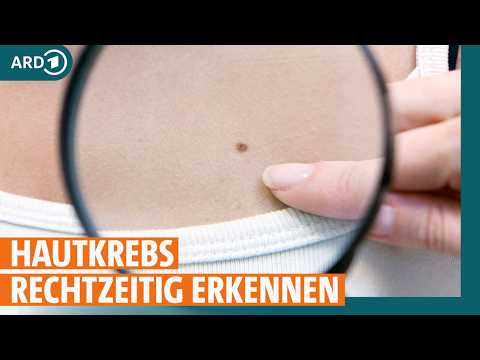 Hautkrebs vorbeugen: Warum das Hautkrebs-Screening so wichtig ist | ARD GESUND