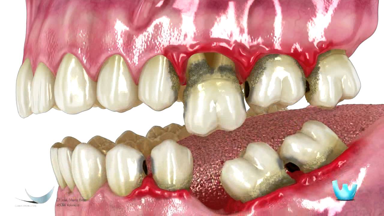 Jacqueline Molina Torres-12