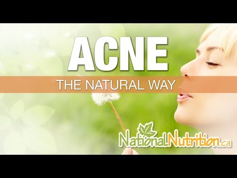 Acne - Natural Treatment Options