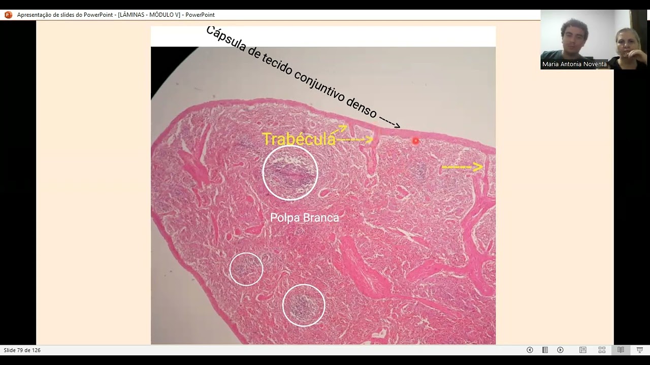 MÓDULO V   AULA 3,1