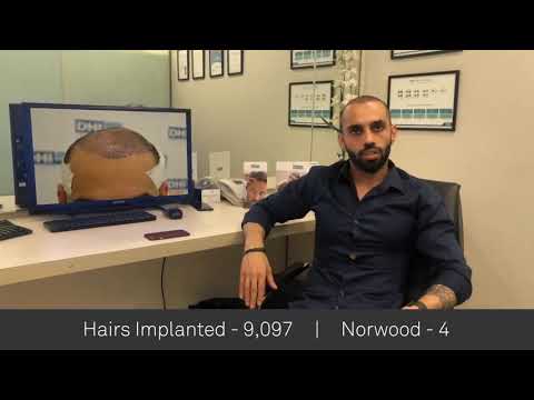 Pradeep Paul Shares His Feedback Regarding DHI Technique- Global Leader in  Hair Transplant
