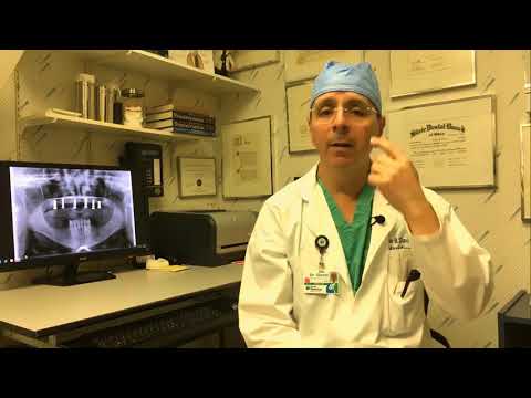 Sinus Lift Post Operative Care