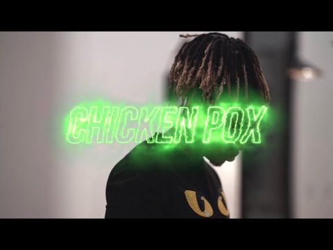 Jock x Plainviewkiet - “Chicken pox” Official Music Video