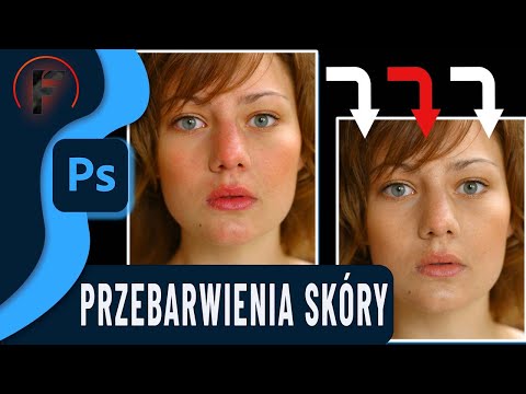 Redukcja przebarwień skóry - Kurs Adobe Photoshop