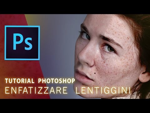 La maschera di decolorazione per un posto rosso su una faccia Crema di decolorazione dimbiancamento di terra santa