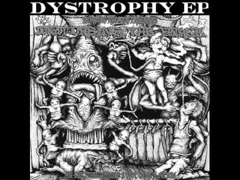 Dystrophy   Where the Kids