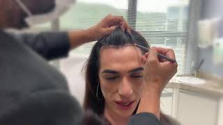 FEMINIZAÇÃO FACIAL / FACIAL FEMINIZATION SURGERY