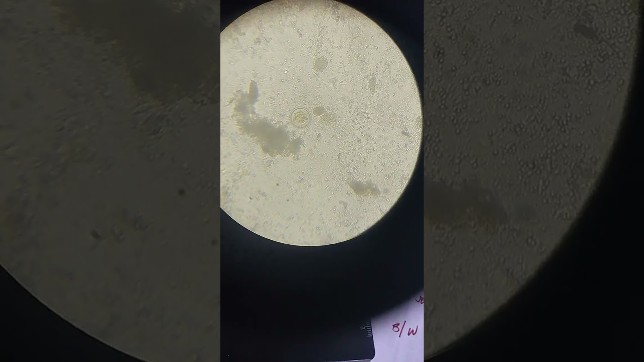 Med tech Life.  #friends #laboratory  #parasite #microscope #medtech