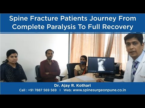 Spine fracture patients Journey from complete paralysis to full recovery @Dr Ajay kothari spine doc