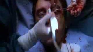 Operation