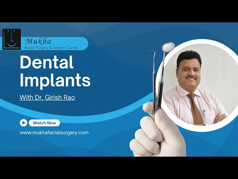 Dental Implants - Mukha Facial Surgery - A one stop center for Dental Implants, Bangalore India