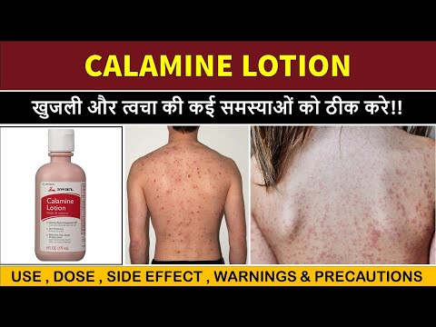 Calamine Lotion