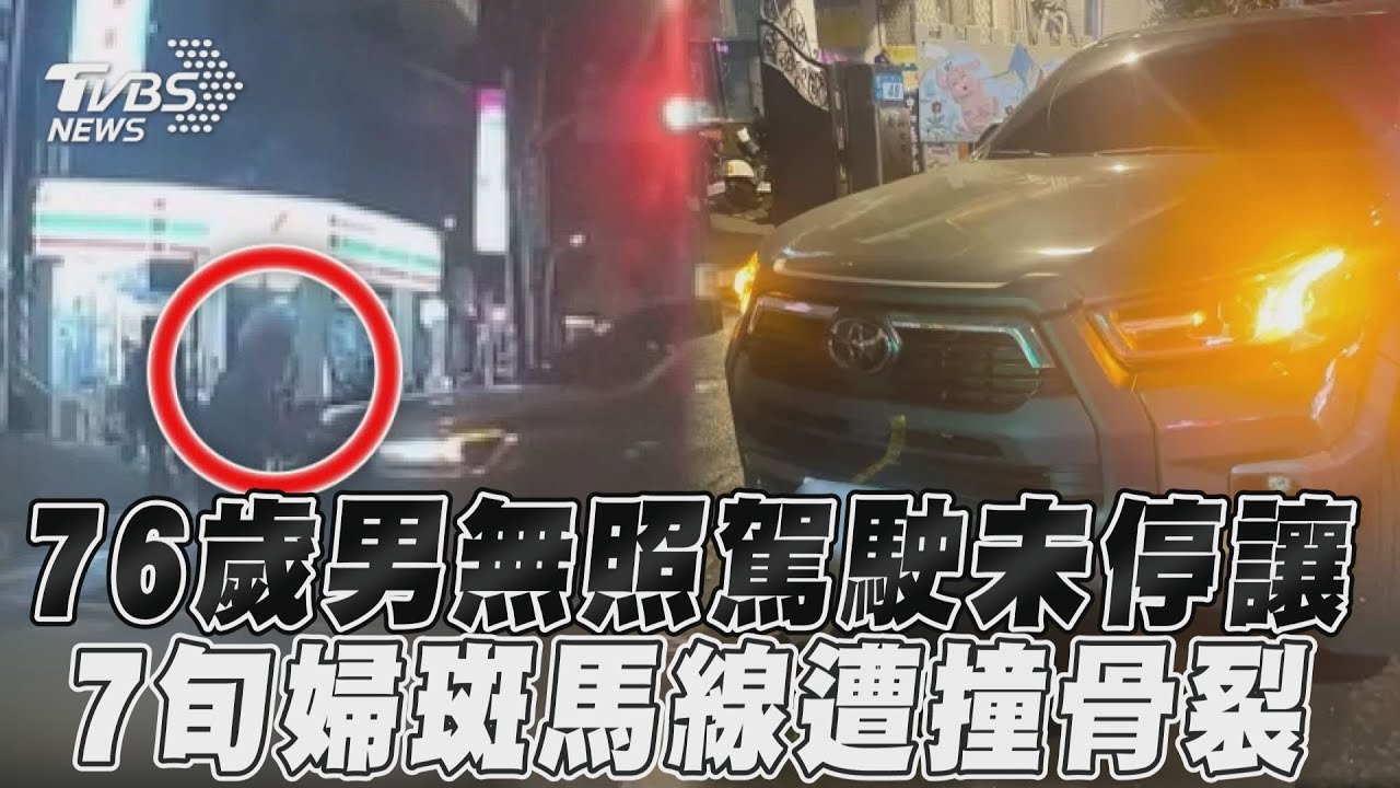 影音/76歲男無照駕駛未停讓 7旬婦斑馬線遭撞骨裂