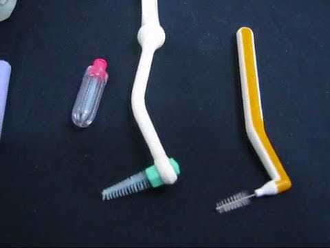 Interdental Brushing, Tooth Town Dental Clinic, Nava India, Coimbatore