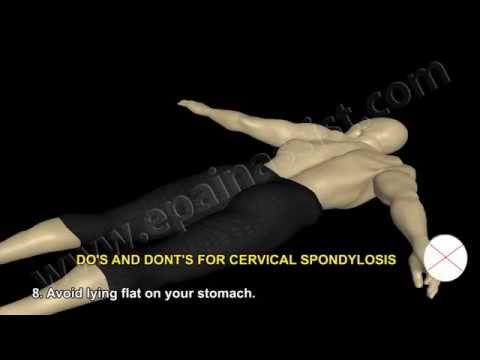 Cervical Spondylosis and Do's and Dont's of Cervical Spondylosis