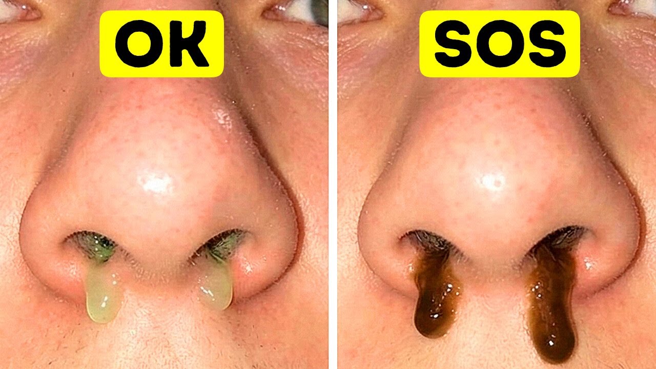 You Are Basically a Walking Mucus Factory