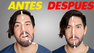 COMO ARREGLAR UN ROSTRO ASIMETRICO - J.M. Montaño